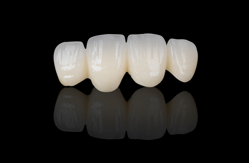 Zirconia-Based Restoration